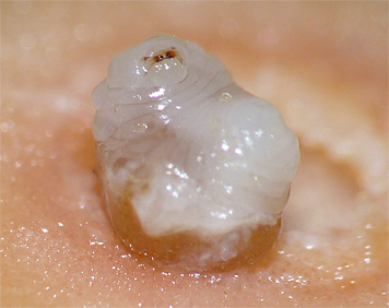 oak gall larva