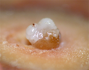 gall wasp larva